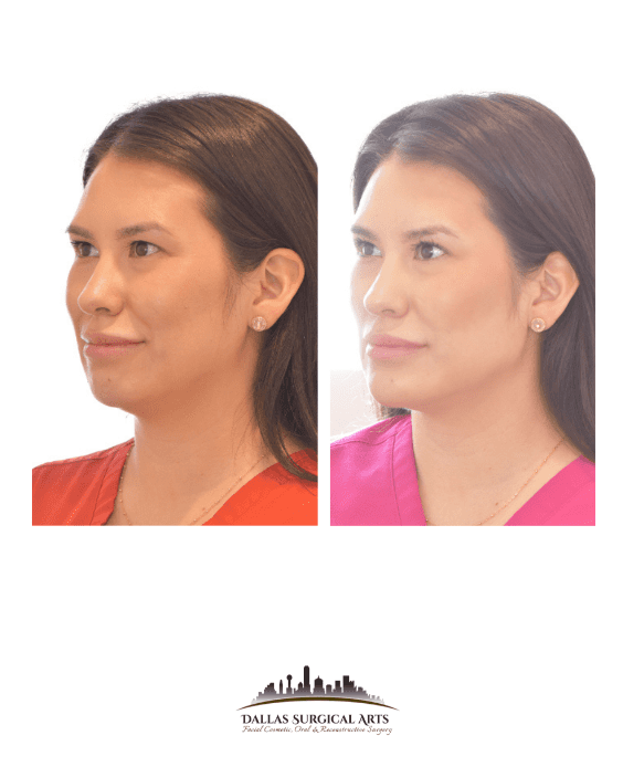 Unveiling Youthful Radiance with Dallas Face Injections: Your Guide to Achieving Age-Defying Beauty