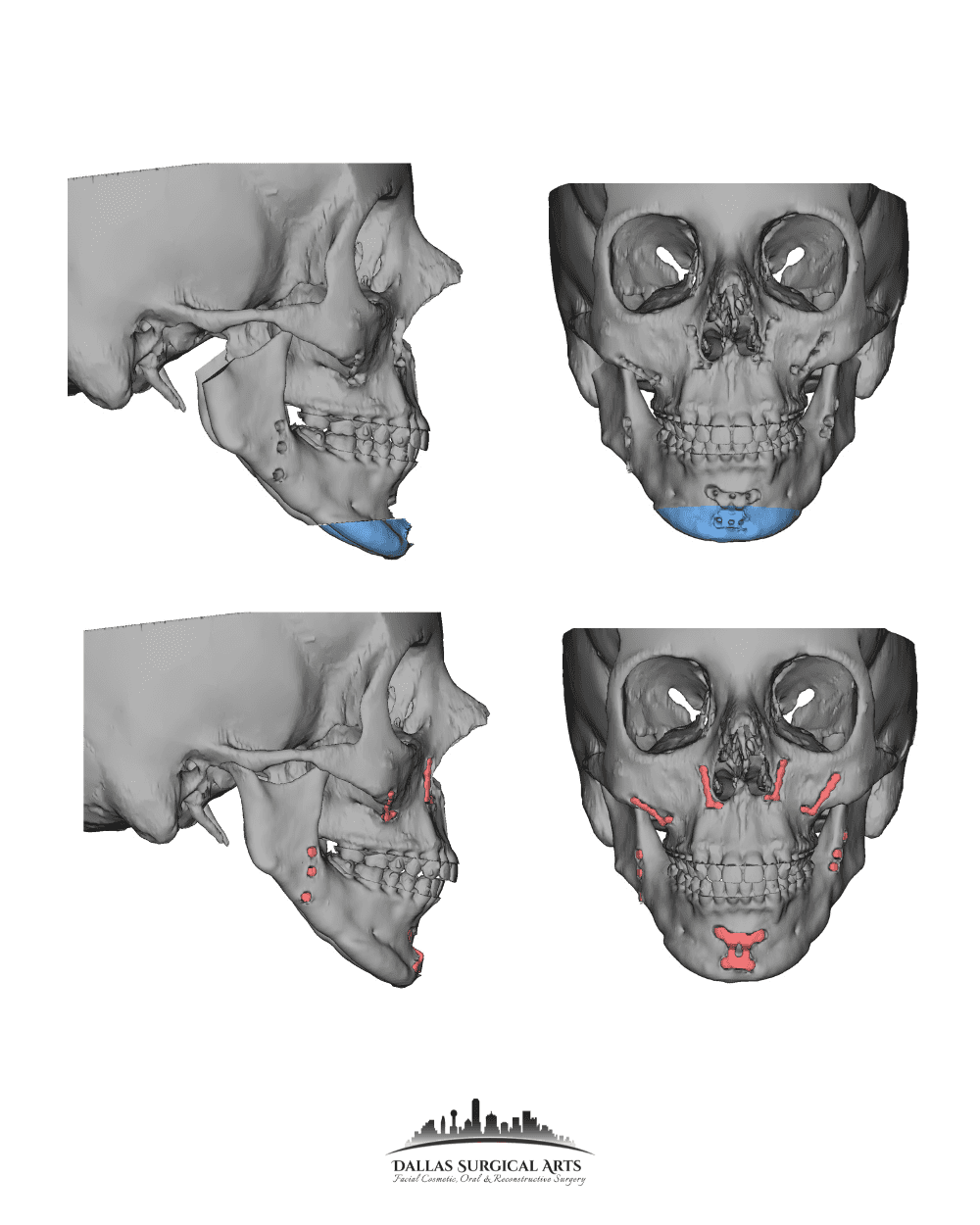 Exploring Innovative Solutions for TMJ Treatment with Dr. Randy Sanovich